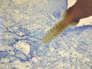 stabbed hypostom of the tick … toluidine-stained semithin section (montage) stabbed hypostom of the tick … toluidine-stained semithin section (montage)